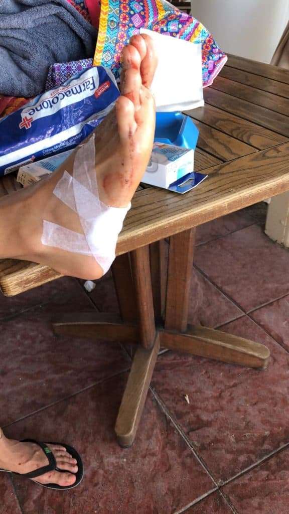Ladispoli: ordinanza no vetro, al via i controlli