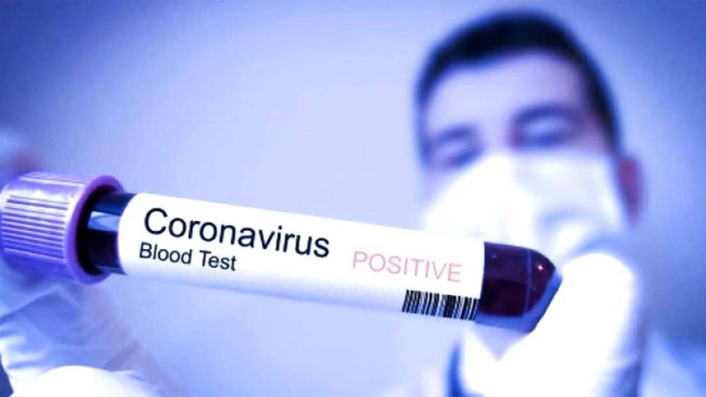 Coronavirus, l'assessore alla sanità del LAzio D'Amato: "Aumentano i casi e raddoppiano i guariti"