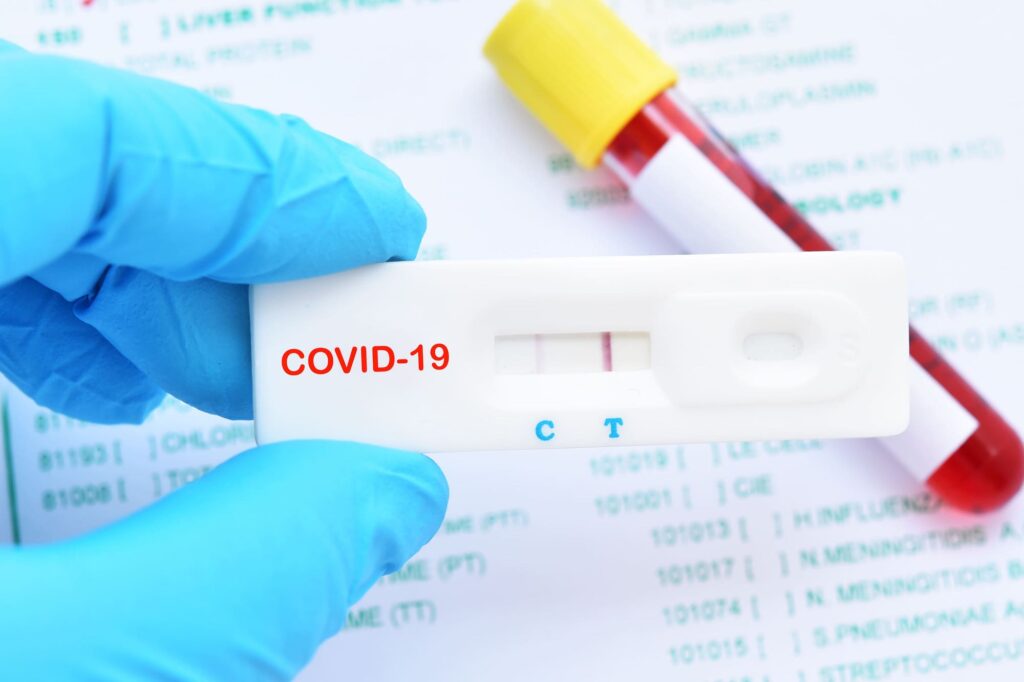 Coronavirus Lazio casi guariti
