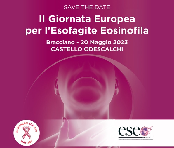 Giornata mondiale patologie eosinofile, ESEO Italia: monumenti illuminati di magenta, dalle Cascate del Niagara al Castello di Bracciano