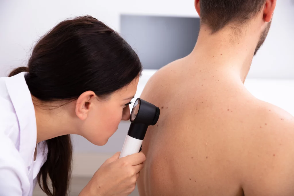 Ladispoli, lunedì 11 agosto sarà organizzata una giornata di prevenzione dermatologica gratuita